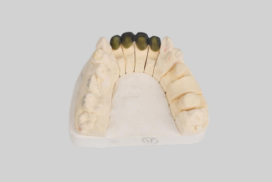 创想三维
：个性化定制你的牙齿  3D打印能帮你