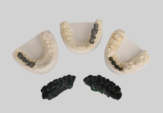 创想三维
：个性化定制你的牙齿  3D打印能帮你