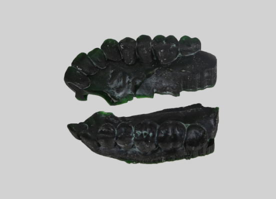 创想三维
：个性化定制你的牙齿  3D打印能帮你