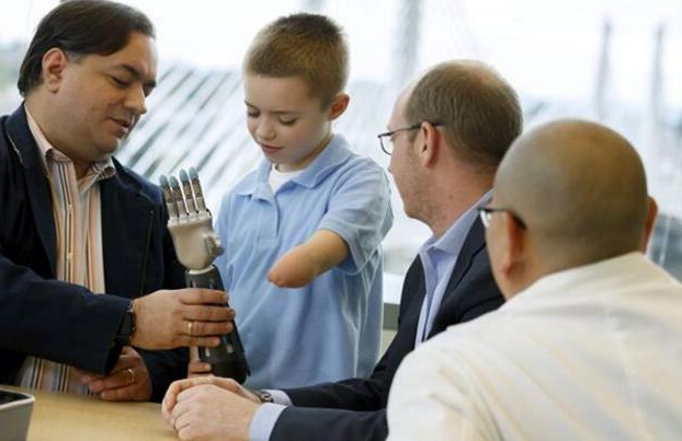 3D打印仿生手臂  成本降到传统假肢的1%