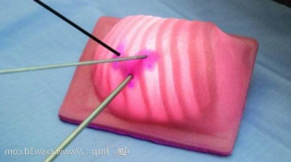 3D打印模型帮助外科医生为罕见复杂的儿童手术做准备