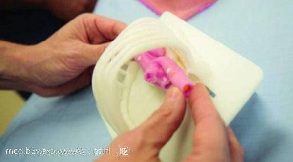 3D打印模型帮助外科医生为罕见复杂的儿童手术做准备