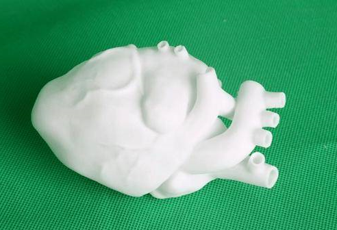 3D打印+医疗风起云涌，“看病难，看病贵”有望成为过去式？