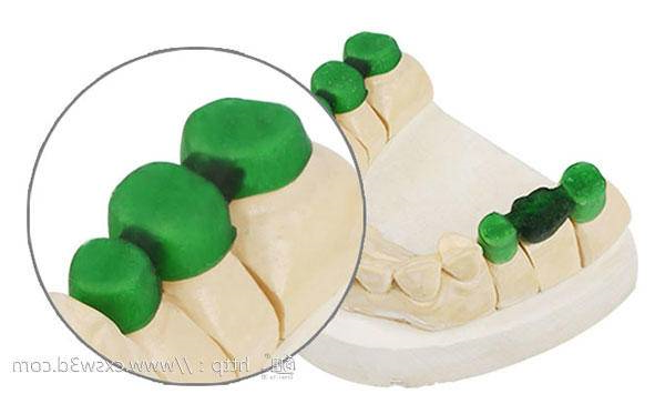 3D打印+医疗风起云涌，“看病难，看病贵”有望成为过去式？