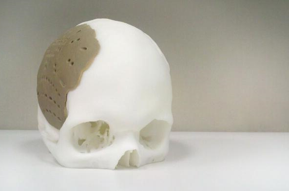 OPM在亚洲建立3D打印医疗设备运营