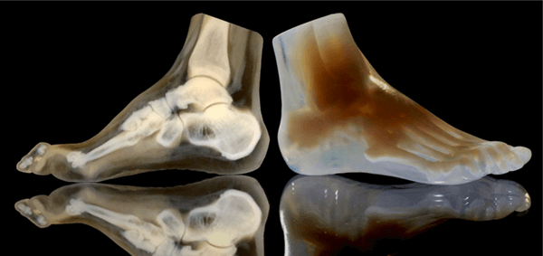 3d打印机打印人体骨骼模型