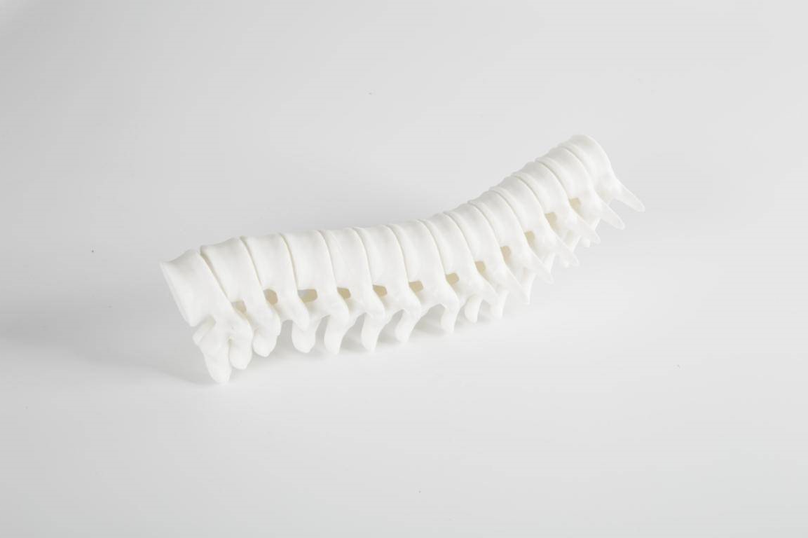 医疗3D打印机模型